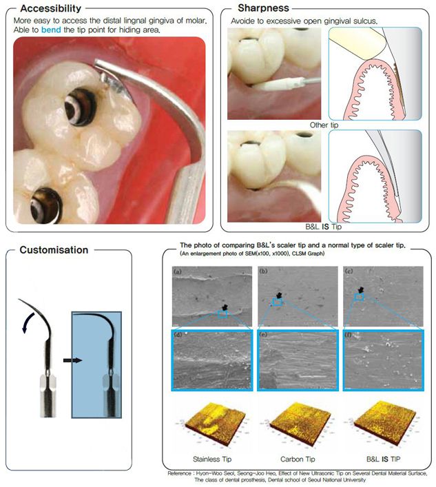 NEW Ultrasonic Implant Scaler Tip   FDA,CE Registration  